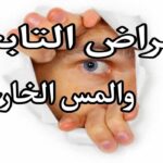 أعراض التابعة في الرحم وطرق علاجها