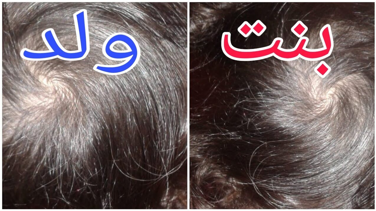 معرفة نوع الجنين من اللسان