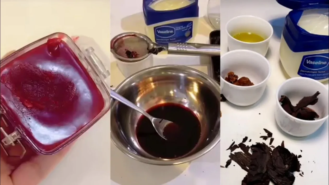 هل الخوا جوا يخيط الجرح