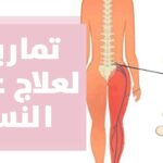 علاج عرق النسا جابر القحطاني