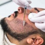 تجربتي في زراعة الذقن الرياض