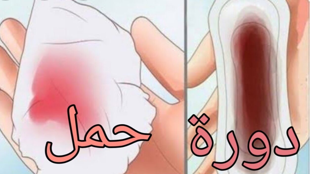 نزول سائل لزج مع دم الدورة