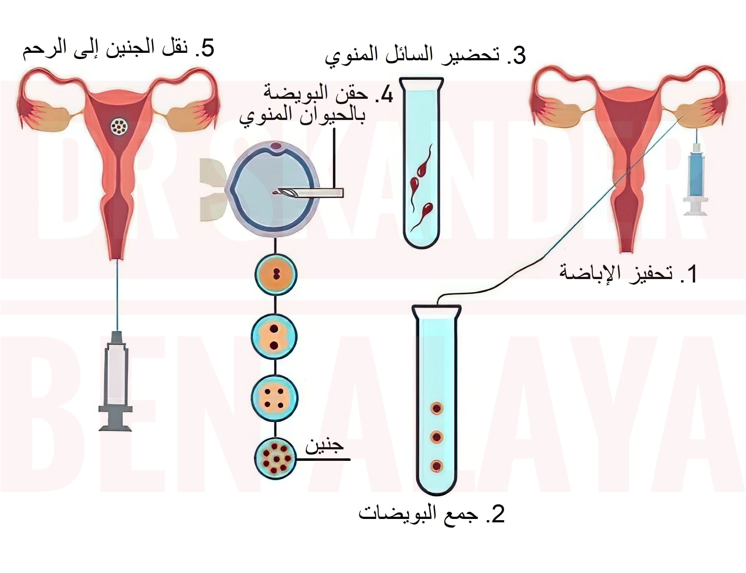 مين عملت تحديد نوع الجنين ونجحت مين عملت تحديد نوع الجنين ونجحت