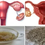 علاج الخوا للبنات