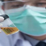 متى تبان نتيجة بول الابل للشعر بعد الاستخدام