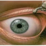 هل العين تسبب نفور الناس