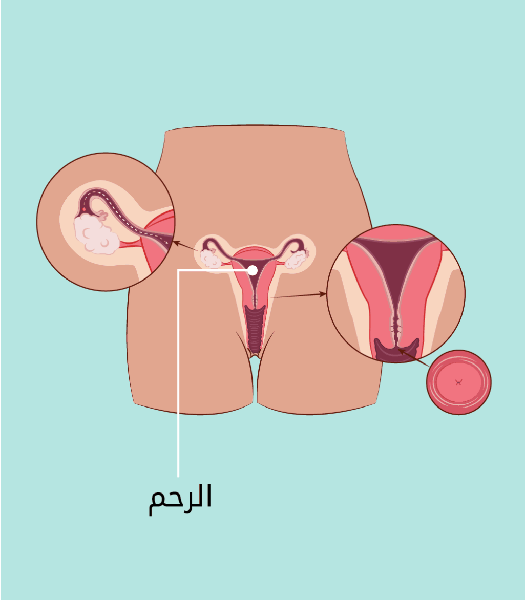 ما هي حدود عانة الرجل
