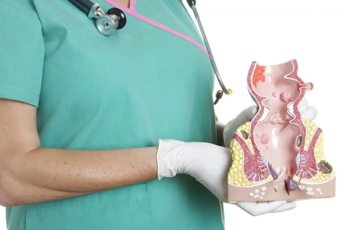 اعراض فشل عمليه البواسير ومدى خطورتها