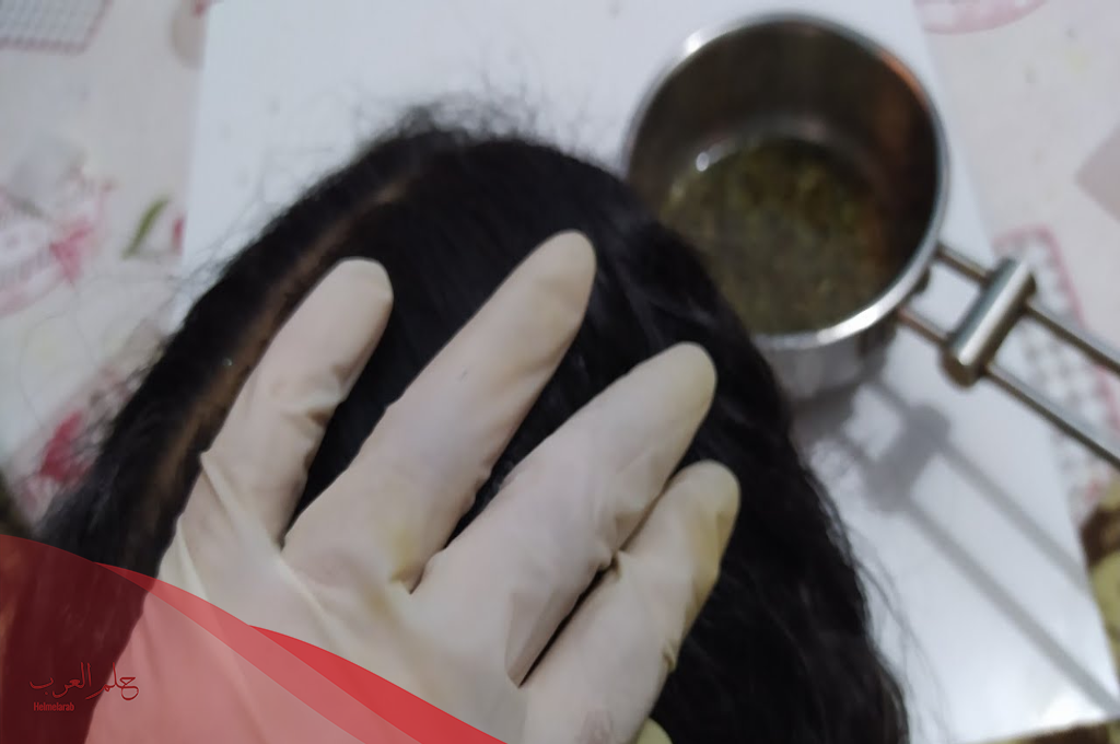 طرق اخراج البرد من الراس