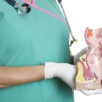 اعراض فشل عمليه البواسير ومدى خطورتها