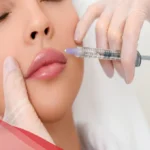 افضل دكتورة تجميل في مكة
