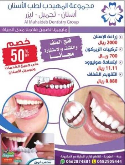 اسعار تلبيس الاسنان في المهيدب