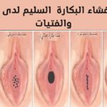 الفرق بين العذراء وليست عذراء