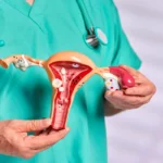 حالات شفيت من البطانة المهاجرة