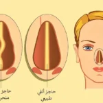 شكل الانف الطبيعي من الداخل بالصور