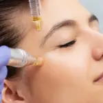 اضرار ابرة بروفايلو