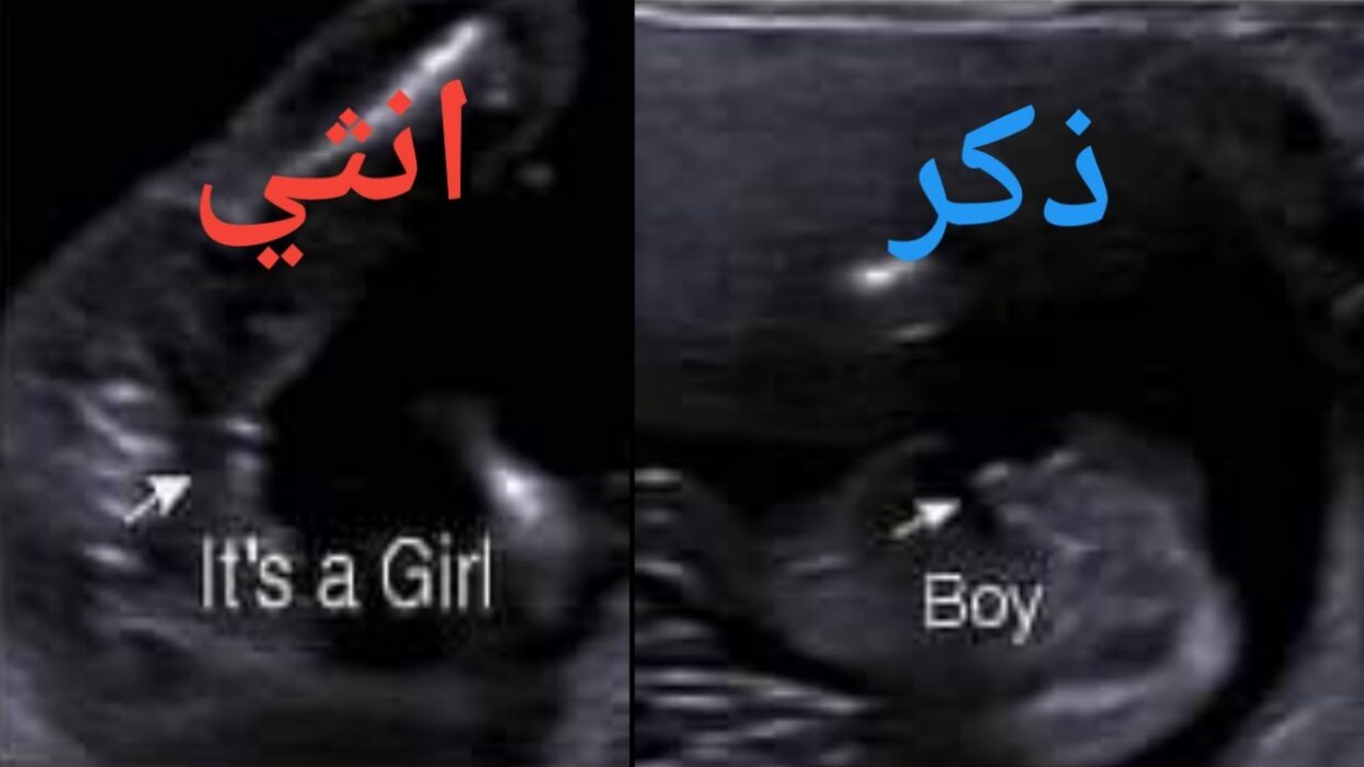 متى تشعر الأم بحركة الجنين إذا كان ولد