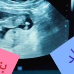 الفرق بين سونار البنت والولد في الشهر الرابع