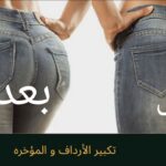 تجربتي في علاج شد المؤخرة
