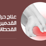 تجربتي مع علاج العفنه للكبار في المنزل