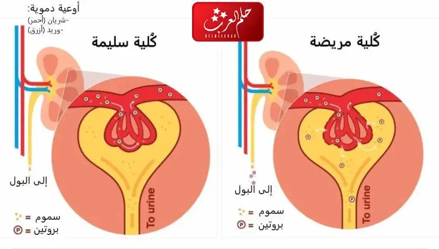 فحص الكلى في المنزل وطرق الاختبار الصحيحة