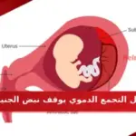 هل التجمع الدموي يوقف نبض الجنين ومتى يختفي التجمع من الرحم