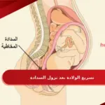 تسريع الولادة بعد نزول السدادة