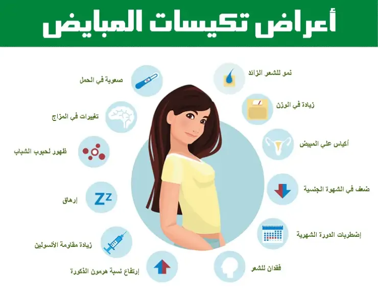 تجربتي مع تكيس المبايض