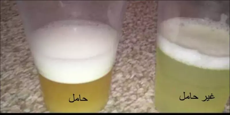 طريقة للكشف عن الحمل قبل الدورة ب 10 ايام