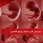 تجربتي في تعديل وضع الجنين وأفضل 3 تمارين لتغيير وضعية الجنين