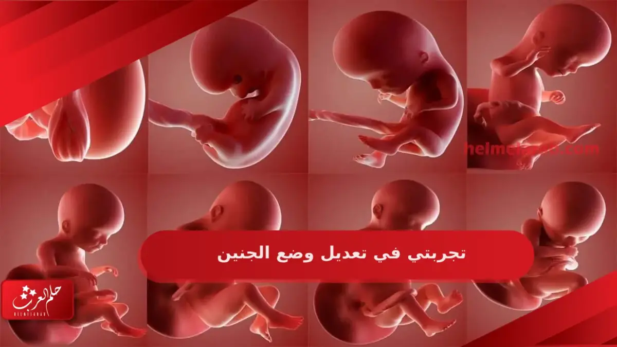 تجربتي في تعديل وضع الجنين وأفضل 3 تمارين لتغيير وضعية الجنين – حلم العرب