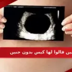 مين قالوا لها كيس بدون جنين