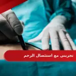 تجربتي مع استئصال الرحم .. تجارب الحياة بعد استئصال الرحم