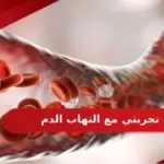 تجربتي مع التهاب الدم وأنواعه ونسبه الشفاء منه
