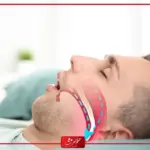 تجربتي مع الشخير وكيف اتخلص من الشخير نهائيا
