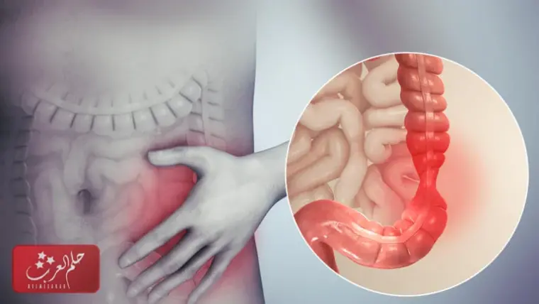 تجربتي مع الكمون للقولون وفوائده وطريقة تحضيره