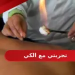 تجربتي مع الكي .. ابرز علامات نجاح الكي