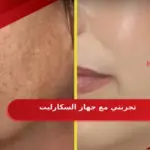 تجربتي مع جهاز السكارليت
