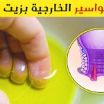 تجربتي مع زيت الزيتون للبواسير