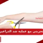 تجربتي مع عملية شد الذراعين