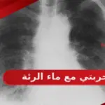 تجربتي مع ماء الرئة وطرق التخلص منها