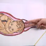 الرحم مفتوح 1 سم ومافي طلق