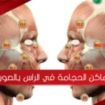 اماكن الحجامة في الراس بالصور