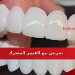 تجربتي مع الفينير المتحرك في تجميل الاسنان