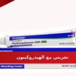 تجربتي مع الهيدروكينون ومتي تظهر نتيجته علي البشرة