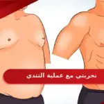 تجربتي مع عملية التثدي