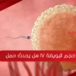 حجم البويضة 17 هل يحدث حمل