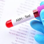 سعر تحليل مخزون البويضات AMH في السعودية