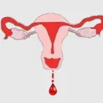 علاج الرجل من دم الحيض