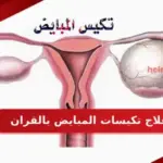 علاج تكيسات المبايض بالقران